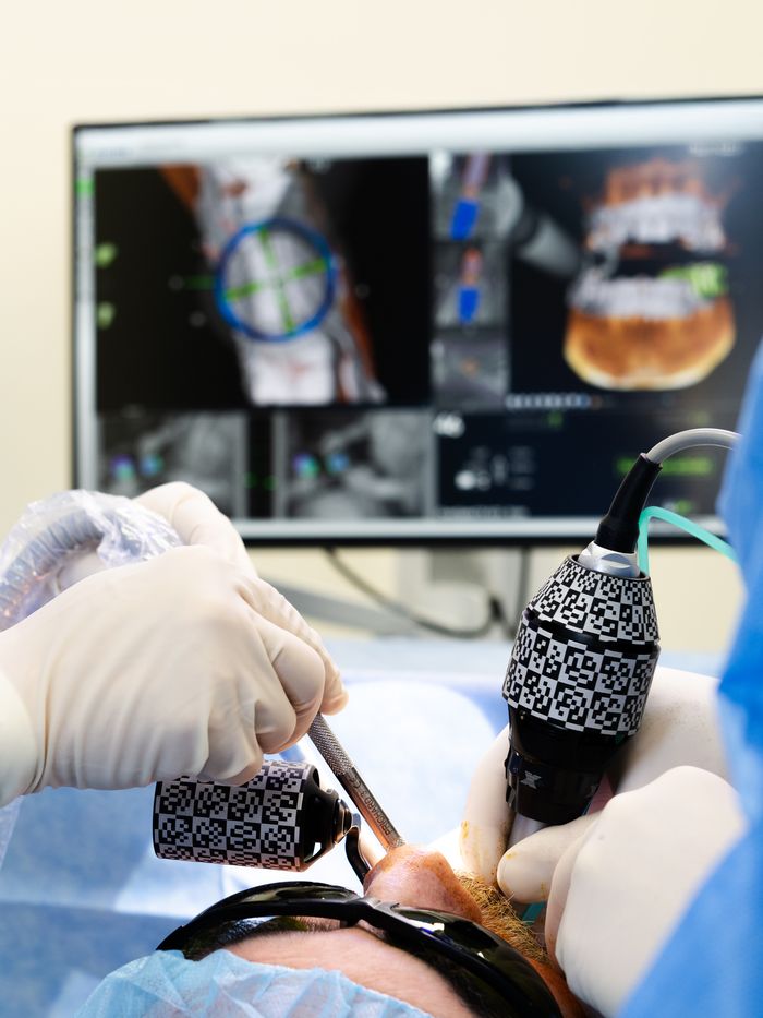 Chirurgie naviguée XGuide – Dentipolis